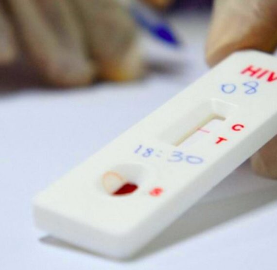 HIV quais são os tipos de teste e quando é necessário fazer Dois Terços